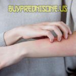 Dampak Pemutih Kulit bagi Kesehatan Fakta yang Harus Diketahui